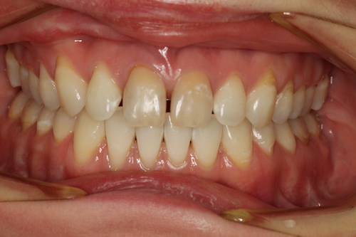 Рис.4 Ситуация до